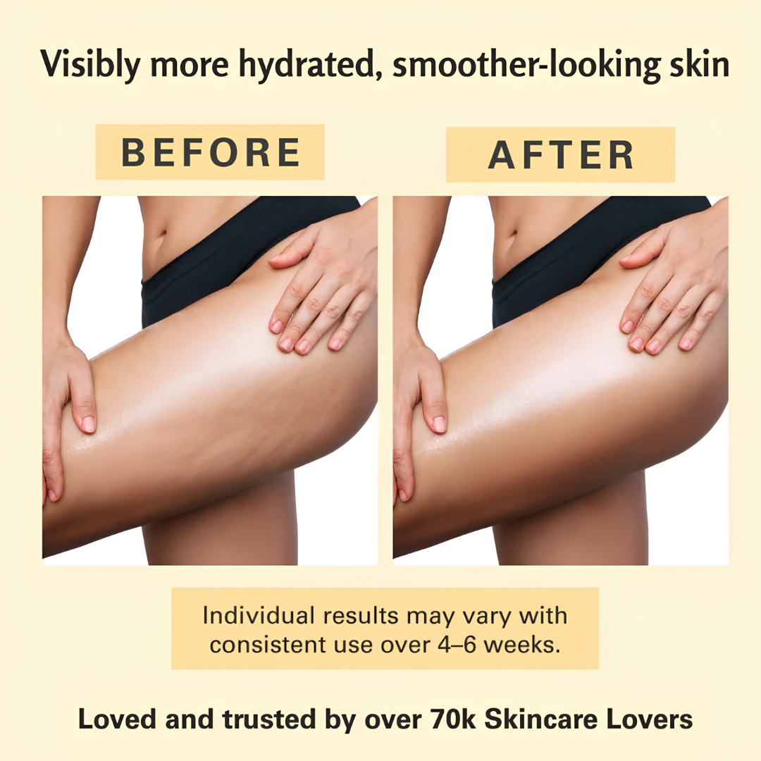 GlowTone™ Anti-Cellulite Oil